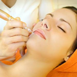 boom di trattamenti di bellezza al laser