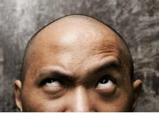 calvizie-problema-adolescenti