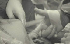 La foto di una neonata-stringe-dito-medico