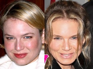 renee-zellweger-prima-e-dopo